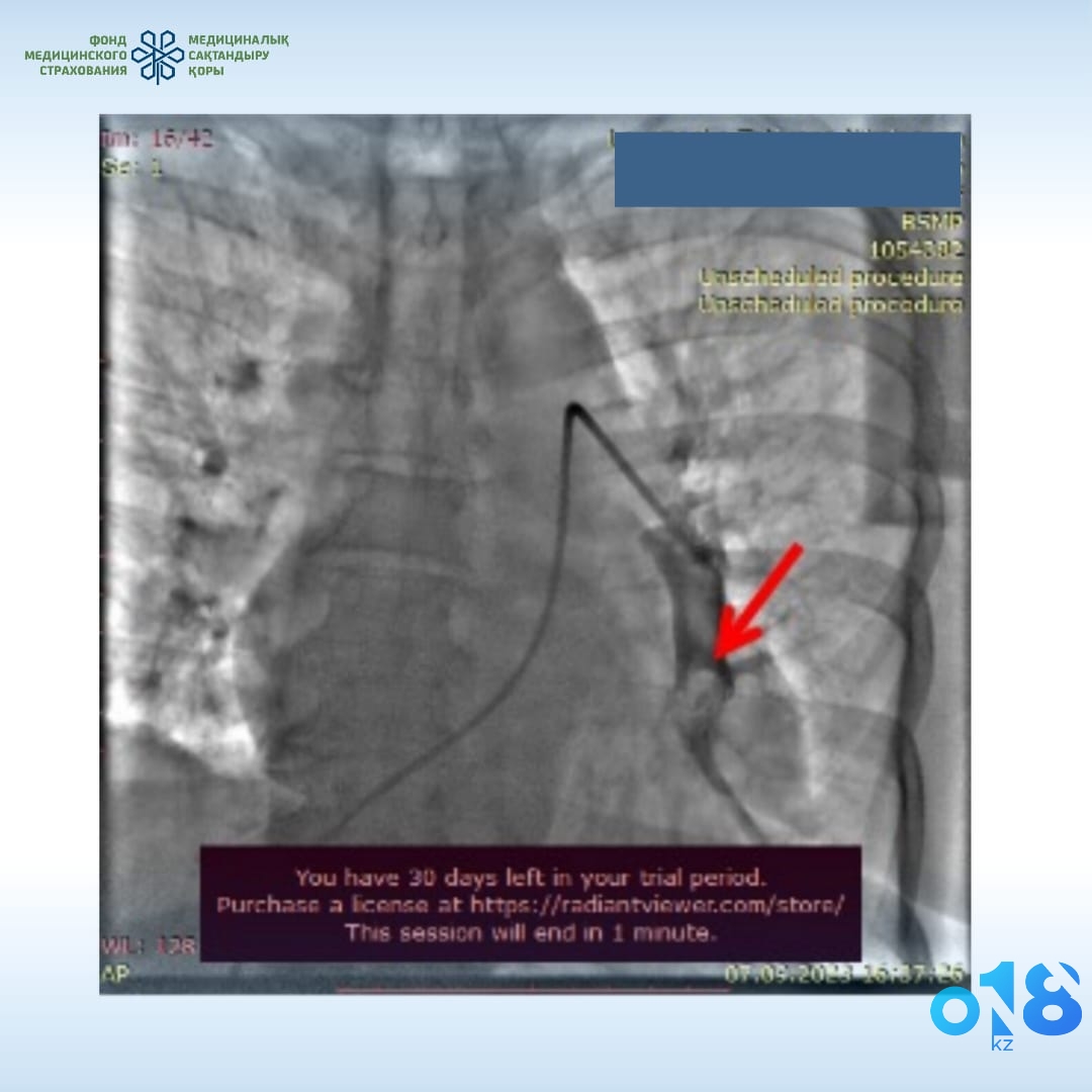 История спасения: как кардиологи из Семея дали второе дыхание » 018.kz -  ABAI AQPARAT